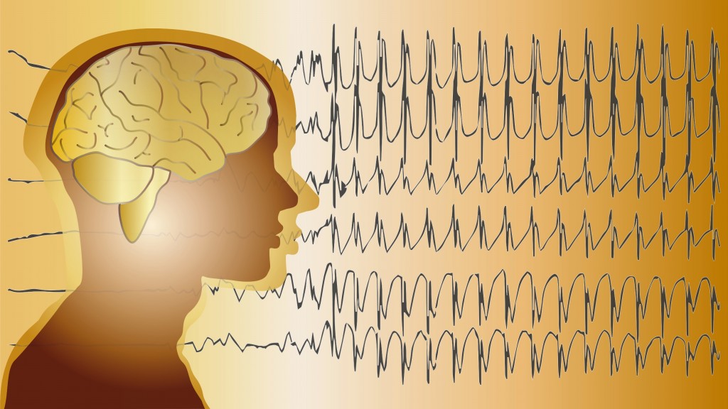 Electroencefalograma